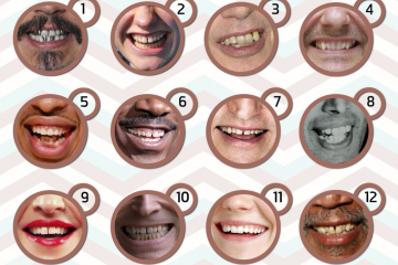 celebrity teeth